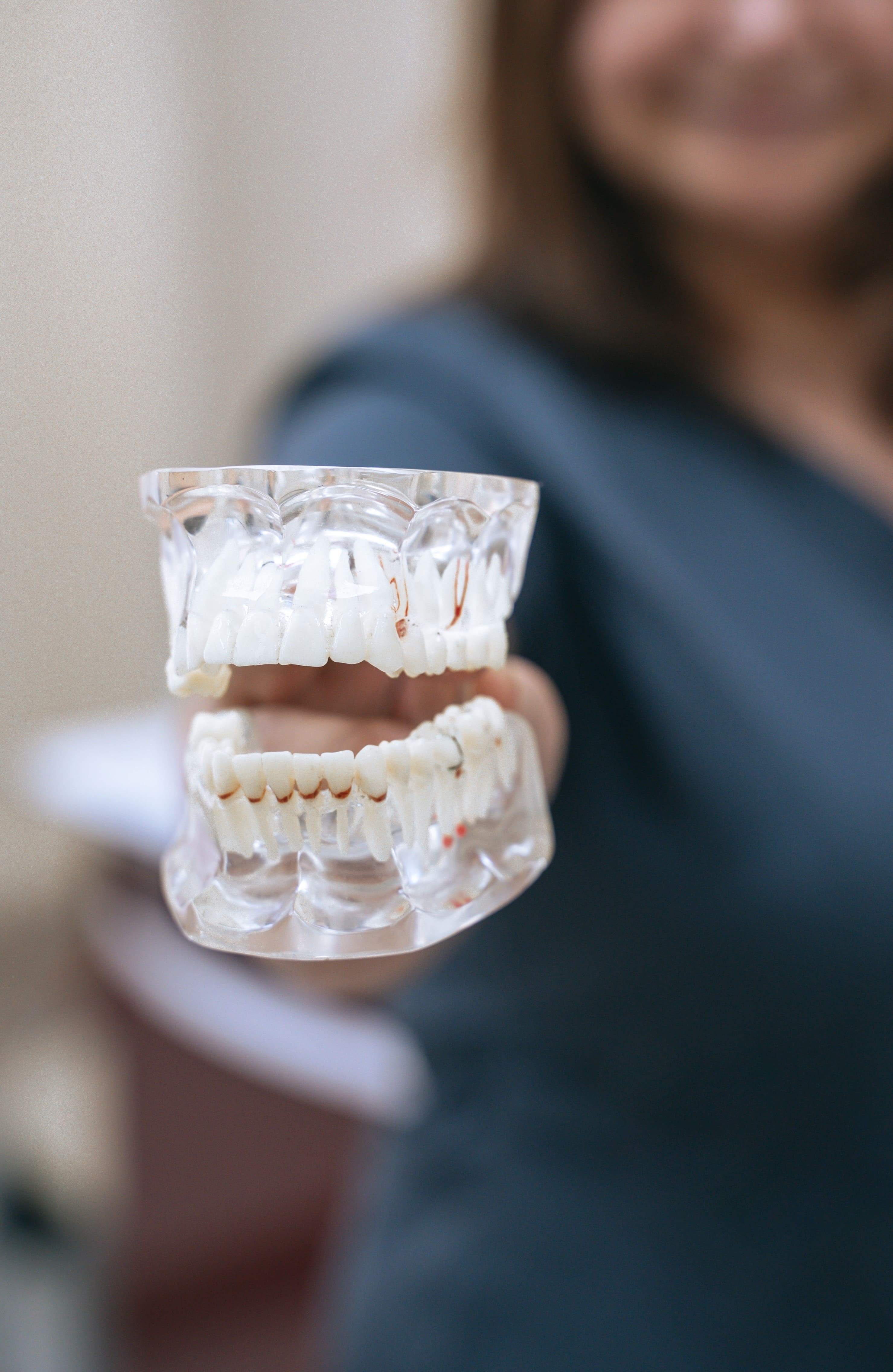 Реминерализация зубов — особенности процедуры